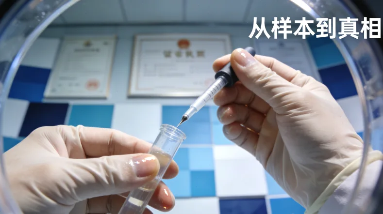 CT引导下肺癌穿刺活检示意图