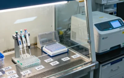 年轻男性在家自测血压，表情疑惑